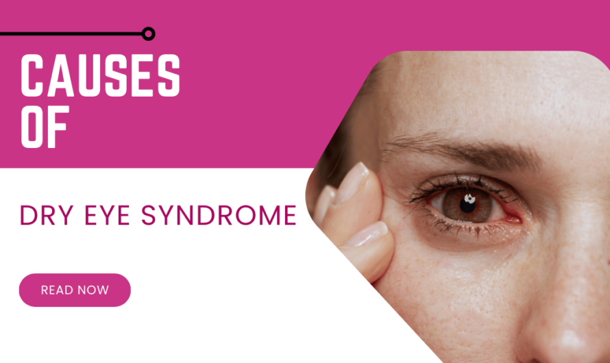 Causes of Dry Eye Syndrome