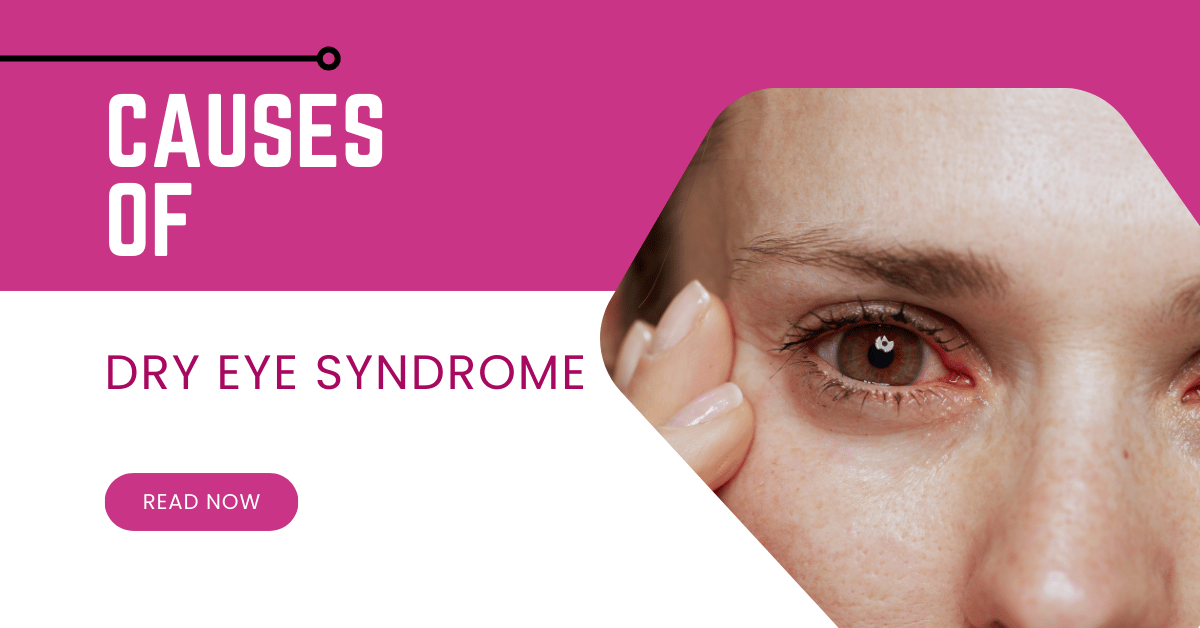 Causes of Dry Eye Syndrome