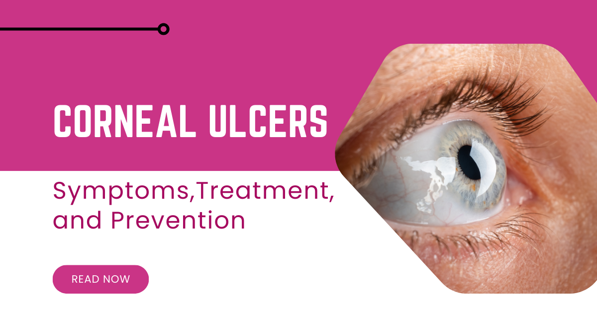 Corneal Ulcers