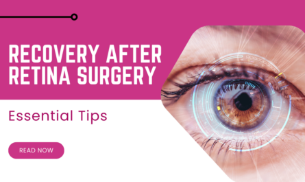 Essential Tips for a Successful Recovery After Retina Surgery