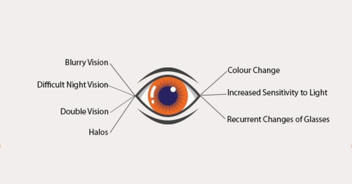 Common Symptoms of Cataracts