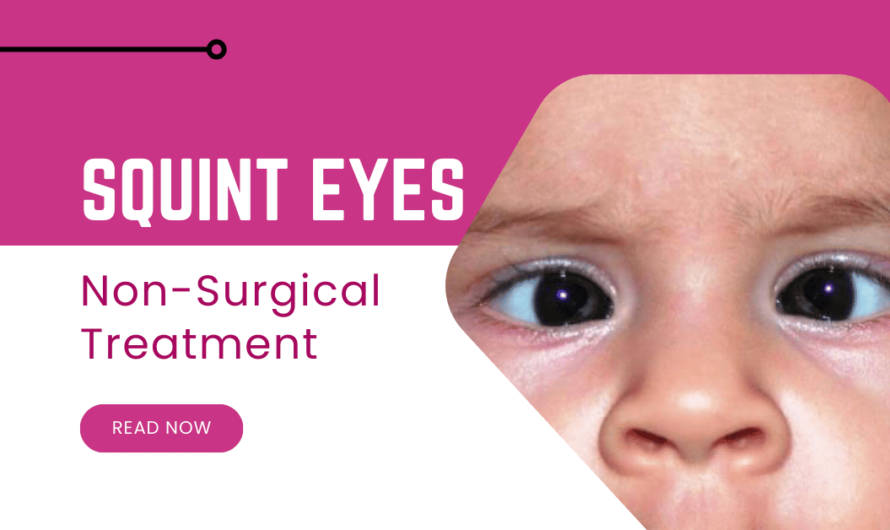 Fixing Squint Eyes: Non-Surgical Treatments That Work