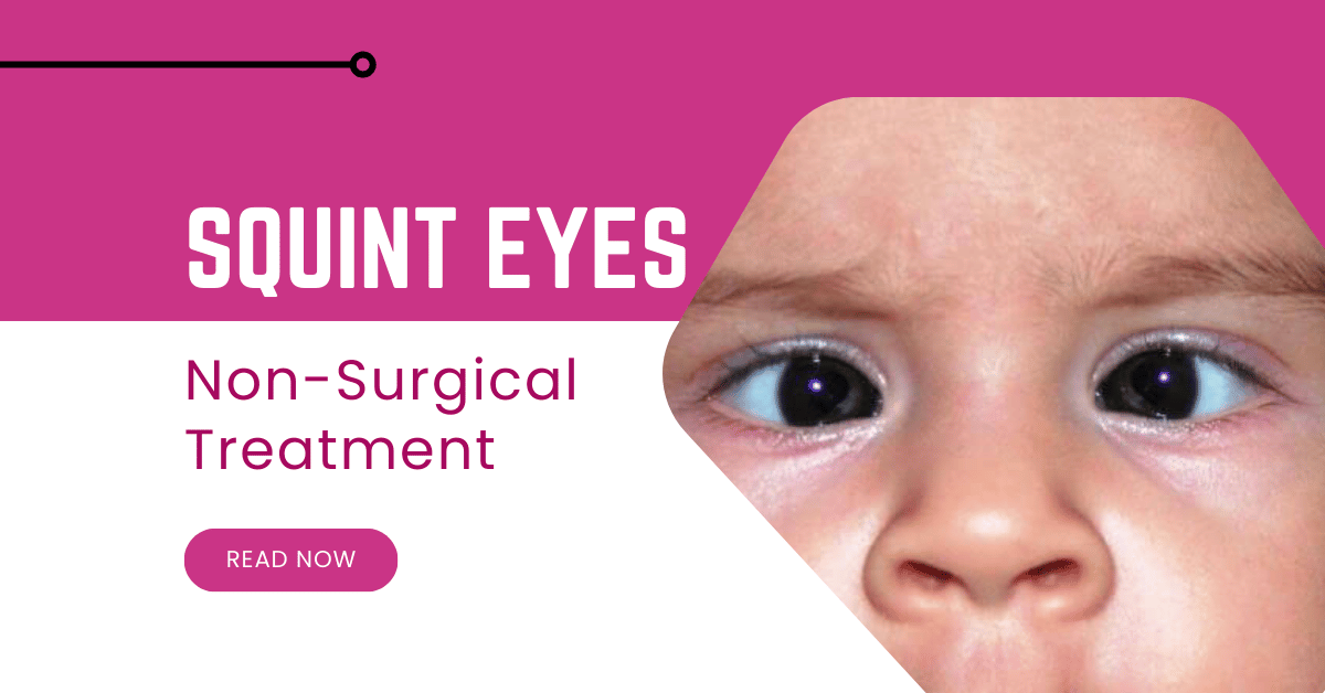 Fixing Squint Eyes: Non-Surgical Treatments That Work