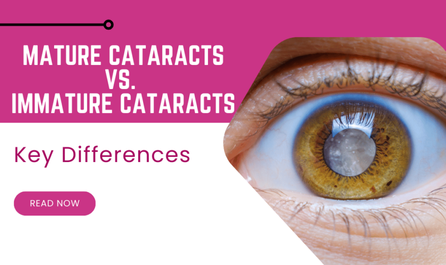 Mature vs. Immature Cataracts: Know the Key Differences