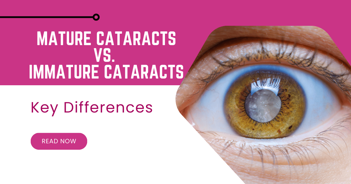 Mature vs. Immature Cataracts: Know the Key Differences