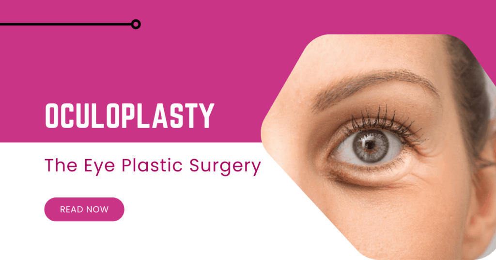 Oculoplasty: Your Guide to Eye Plastic Surgery
